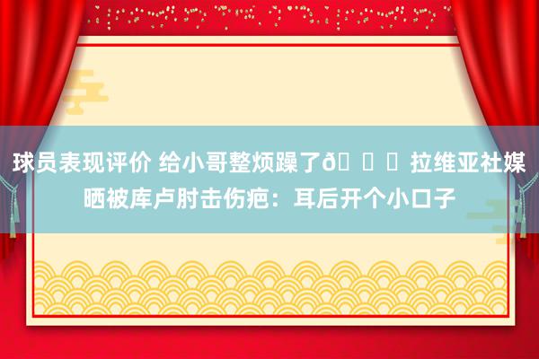 球员表现评价 给小哥整烦躁了😅拉维亚社媒晒被库卢肘击伤疤：耳后开个小口子