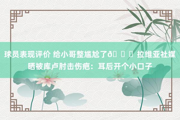 球员表现评价 给小哥整尴尬了😅拉维亚社媒晒被库卢肘击伤疤：耳后开个小口子